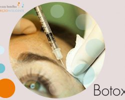 Toxina Botulínica – O Botox®