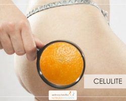 CELULITE
